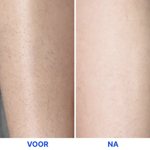 SilkTouch - Pijnloze Precisie Trimmer
