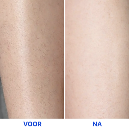 SilkTouch - Pijnloze Precisie Trimmer